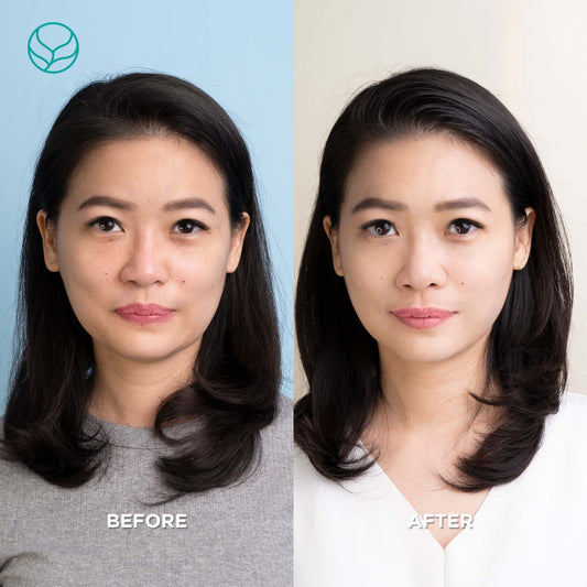 Rahasia Kulit Glowing Tanpa Harus Treatment Ke Klinik