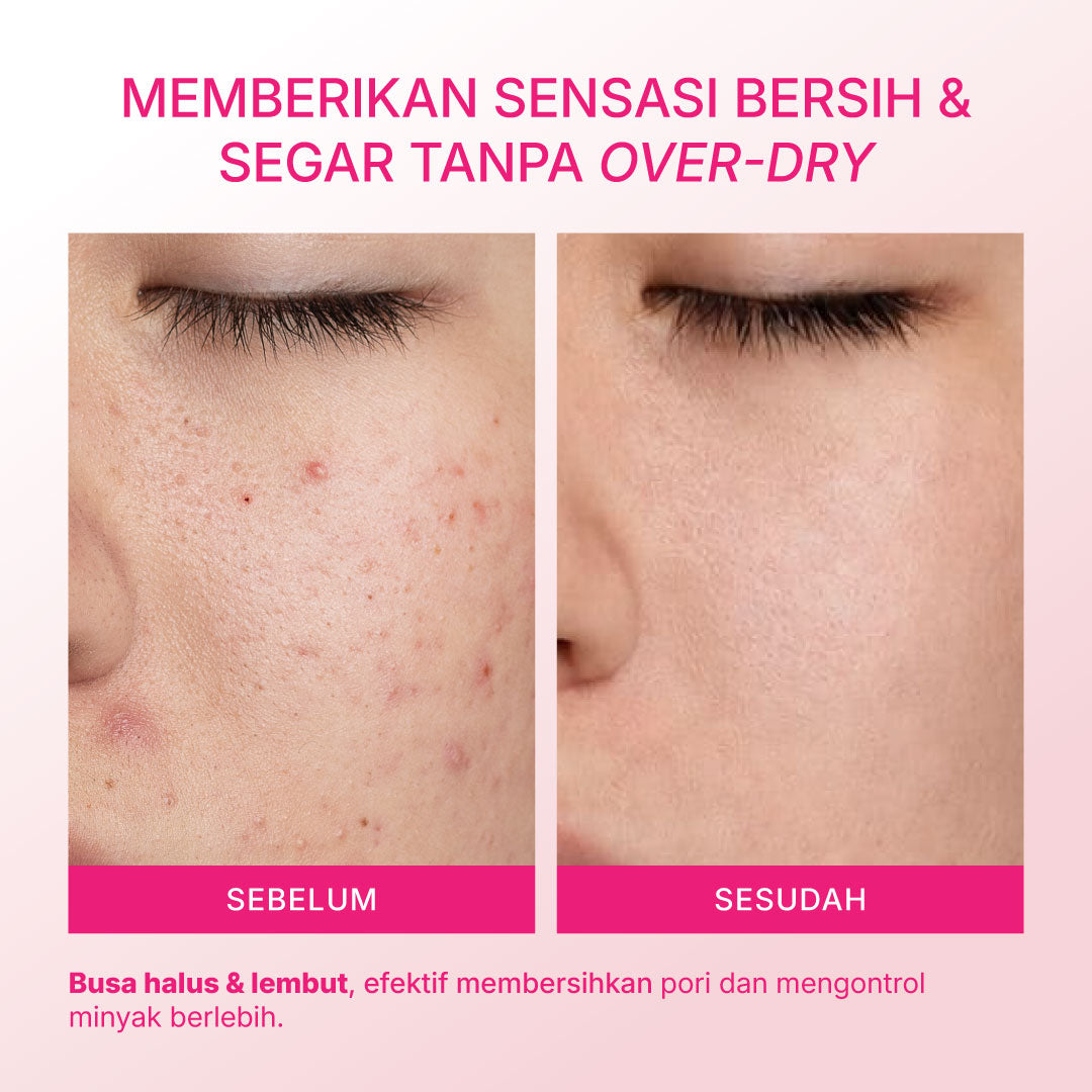 Mineral Botanica Perfect Delight Gentle Cleanser Low pH – Non-SLS/SLES untuk Kulit Acne-Prone