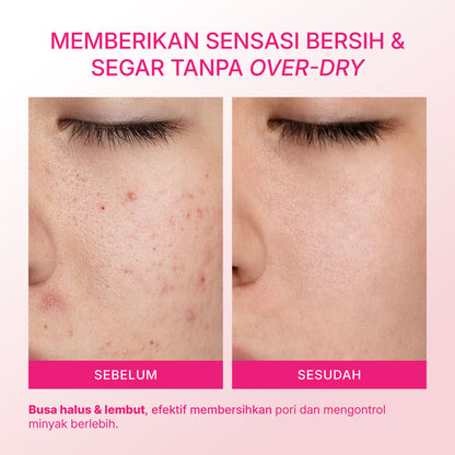 Mineral Botanica Perfect Delight Gentle Cleanser Low pH – Non-SLS/SLES untuk Kulit Acne-Prone